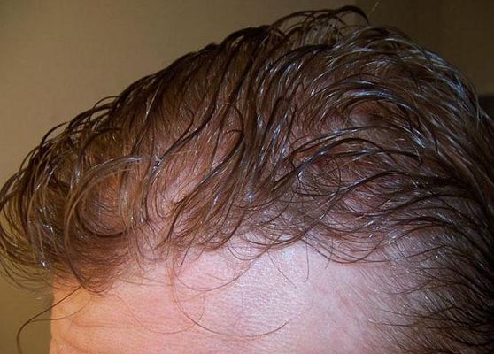 Good price 100% Human Hair Men'S Toupee For Natural Hairline Transformation online