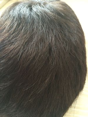 Good price Custom Hair Replacement Systems 12